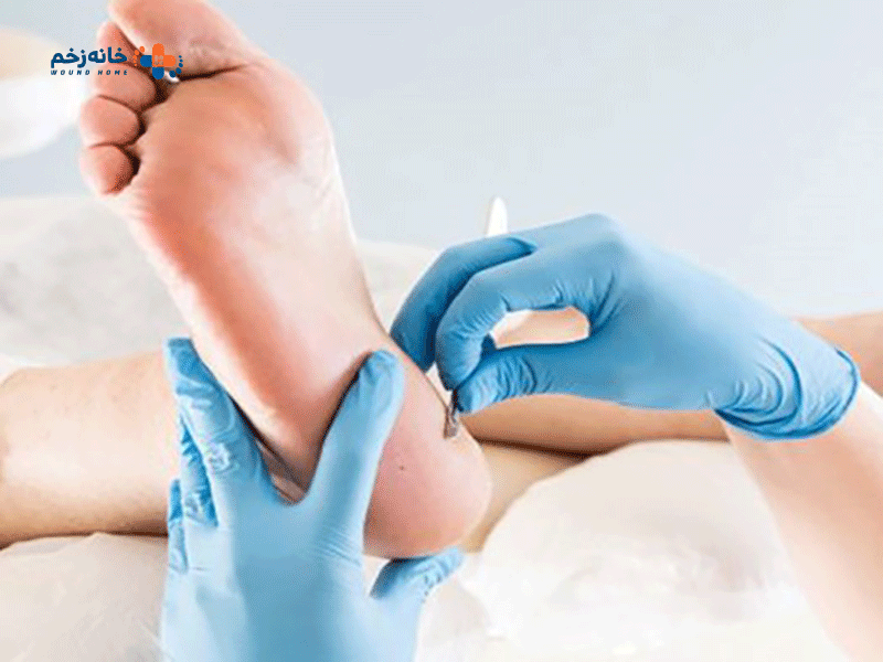 روش های درمان زخم کف پای دیابتی